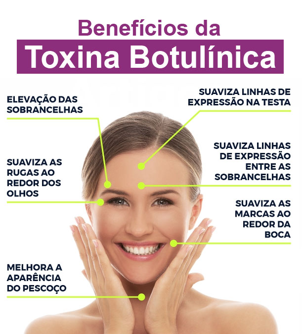 beneficios - Toxina Botulínica